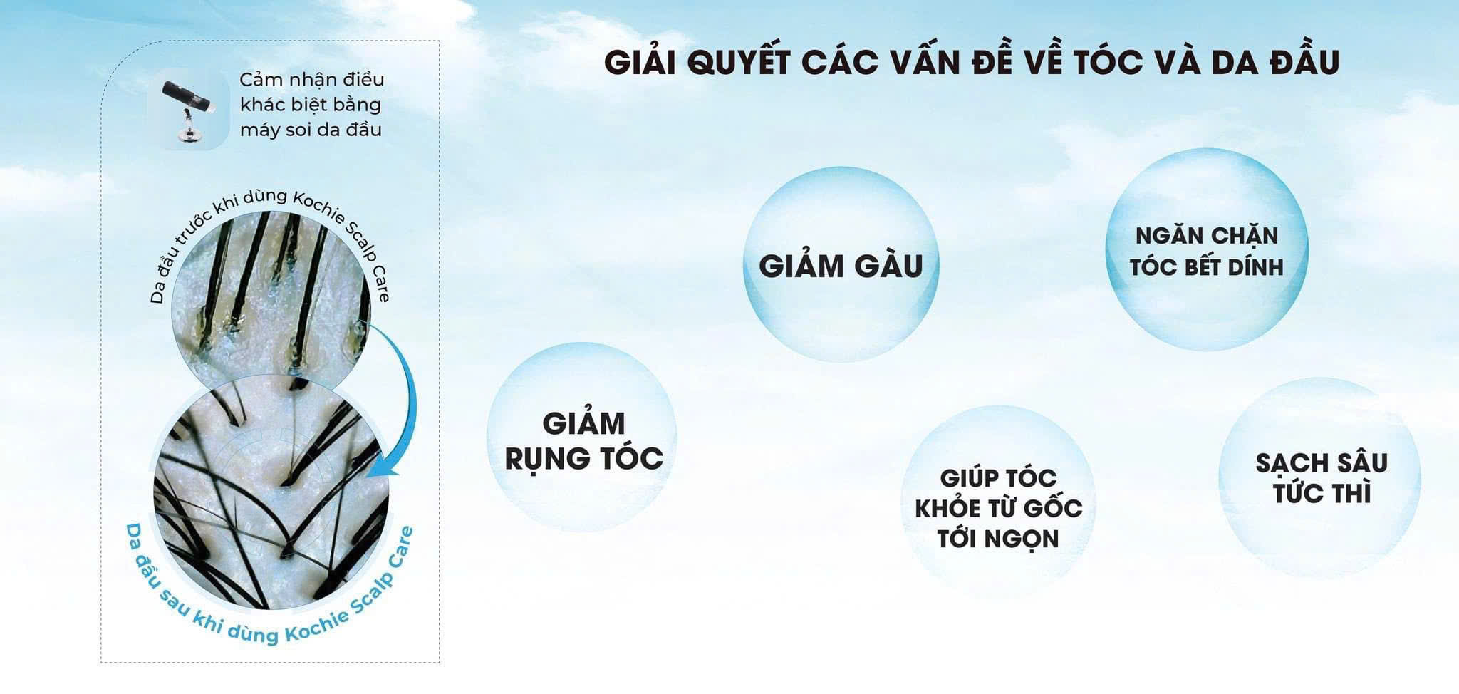 Why Your Hair Needs a Scalp Detox (Especially in Da Nang’s Heat!)